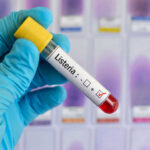 Listeria positive test tube