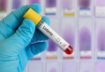 Listeria positive test tube