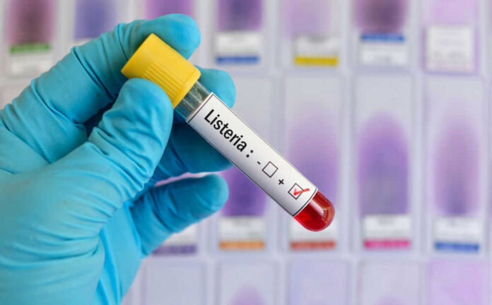 Listeria positive test tube