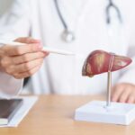 Doctor pointing at a liver model with a pen