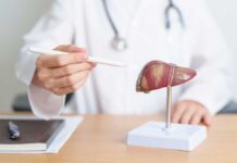 Doctor pointing at a liver model with a pen