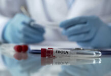 CDC’s VOLUNTEER Plea: Ebola at Airports?! Ebola test tubes on lab table with gloved scientist in background