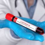 A laboratory technician holding a vial labeled 'Listeria monocytogenes' above a petri dish with green culture