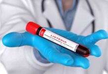A laboratory technician holding a vial labeled 'Listeria monocytogenes' above a petri dish with green culture