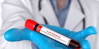 A laboratory technician holding a vial labeled 'Listeria monocytogenes' above a petri dish with green culture