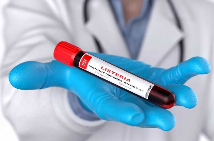 A laboratory technician holding a vial labeled 'Listeria monocytogenes' above a petri dish with green culture